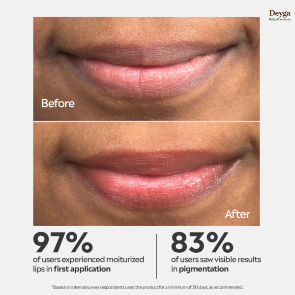 Deyga Beetroot Lip Balm Stick 5.5ml – Natural Tinted Lip Care for Dry & Chapped Lips - Image 2