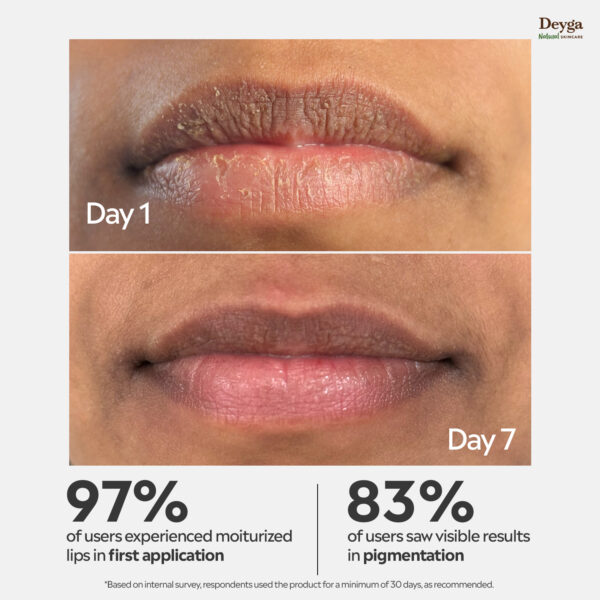 Deyga Beetroot Lip Balm 10g – Natural Lip Care for Dry & Chapped Lips - Image 2