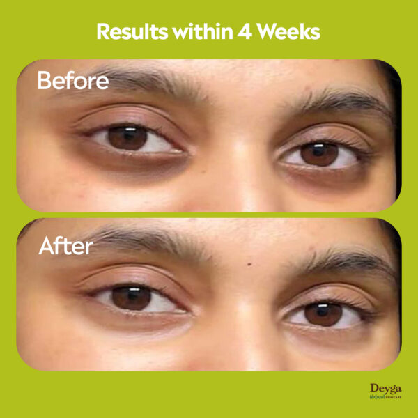 Deyga Under Eye Cream 15g – Natural Dark Circle Remover & Hydrating Eye Care - Image 2